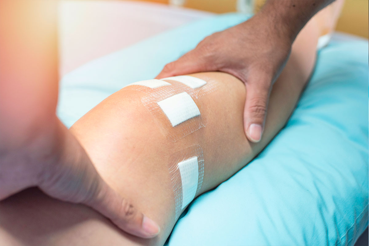 Tratamiento avanzado de las fracturas - Traumatología Gijón